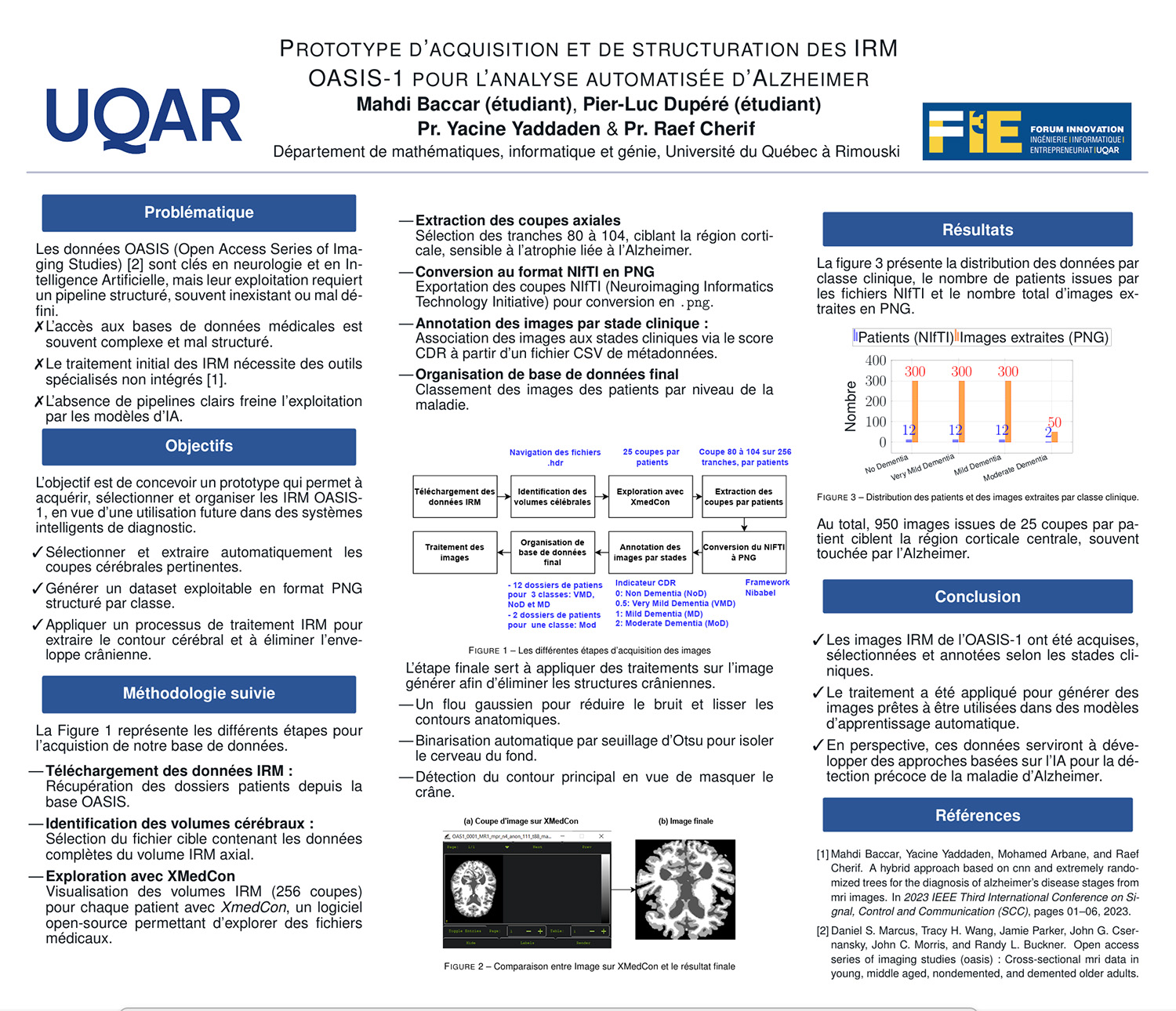 Prototype d’acquisition et de traitement des IRM OASIS-1 pour la détection automatisée des stades de l’Alzheimer